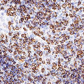 CD148 was detected in immersion fixed paraffin-embedded sections of human tonsil using Mouse Anti-Human CD148 Monoclonal Antibody (Catalog #NBP3-45155) at 5 µg/ml for 1 hour at room temperature followed by incubation with the Anti-Mouse IgG VisUCyte™ HRP Polymer Antibody (Catalog # VC001). Before incubation with the primary antibody, tissue was subjected to heat-induced epitope retrieval using VisUCyte Antigen Retrieval Reagent-Basic (Catalog # VCTS021). Tissue was stained using DAB (brown) and counterstained with hematoxylin (blue). Specific staining was localized to the membrane of tonsil lymphocytes.