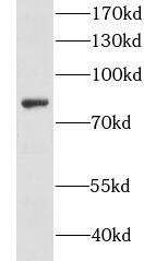 Jurkat cells were subjected to SDS PAGE followed by western blot with (CKAP2L antibody) at dilution of 1:500