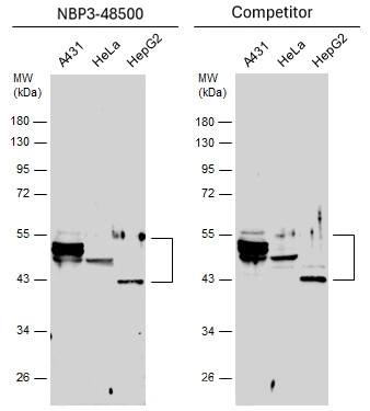Various whole cell extracts (30 μg) were separated by 10% SDS-PAGE, and the membranes were blotted with Cytokeratin 10 antibody diluted at 1:10000 and competitor's antibody diluted at 1:500. The HRP-conjugated anti-rabbit IgG antibody was used to detect the primary antibody.