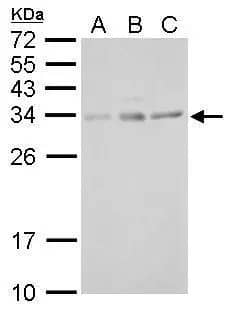 UCP4 antibody detects SLC25A27 protein by Western blot analysis.A. 30 μg SK-N-SH whole cell lysate/extractB. 30 μg IMR32 whole cell lysate/extractC. 30 μg SK-N-AS whole cell lysate/extract12 % SDS-PAGEUCP4 antibody dilution: 1:1000