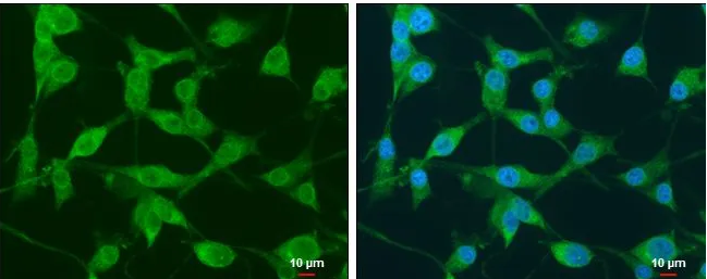  U87-MG cells were fixed in 4% paraformaldehyde at RT for 15 min.Green: Nek1 protein stained by Nek1 antibody diluted at 1:500.Blue: Hoechst 33342 staining.Scale bar = 10 μm.
