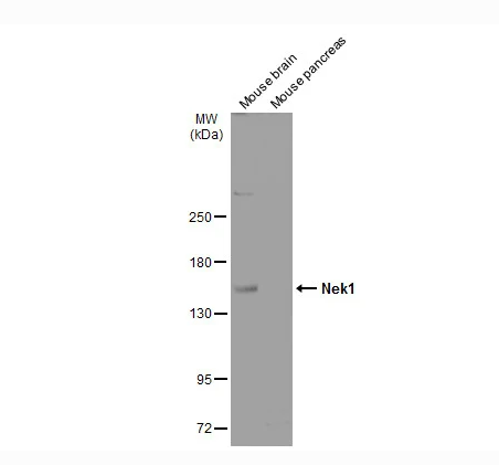 Various tissue extracts (50 μg) were separated by 5% SDS-PAGE, and the membrane was blotted with Nek1 antibody diluted at 1:1000. The HRP-conjugated anti-rabbit IgG antibody (NBP2-19301) was used to detect the primary antibody.