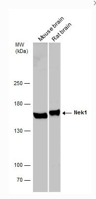 Various tissue extracts (50 μg) were separated by 5% SDS-PAGE, and the membrane was blotted with Nek1 antibody diluted at 1:1000.