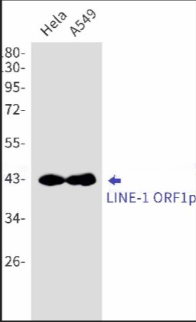 Western blot:LINE-1 ORF1p Antibody (R022H1) [NBP3-52051] - detection of LINE-1 ORF1p in Hela,A549 cell lysates using LINE-1 ORF1p Rabbit mAb(1:1000 diluted).Predicted band size:40kDa.Observed band size:42kDa.