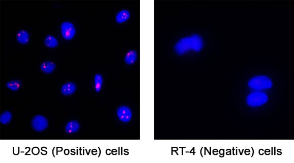 Glucagon was detected in immersion fixed U2OS human osteosarcoma cells (Positive) & absent in RT‑4 human urinary bladder transitional cell papilloma (Negative) using Mouse Anti-Human/Mouse Glucagon NorthernLights™ NL557-conjugated Monoclonal Antibody (Catalog # NL1249R) at 8 µg/mL for 3 hours at room temperature. Cells were stained using the NorthernLights™ 557-conjugated Anti-Mouse IgG Secondary Antibody (red; Catalog # NL007) and counterstained with DAPI (blue). Specific staining was localized to Nucleolus. View our protocol for Fluorescent ICC Staining of Cells on Coverslips.