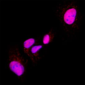 SOX9 was detected in immersion fixed U‑251 MG human glioblastoma cell line using Goat Anti-Human SOX9 NorthernLights™ NL557-conjugated Antigen Affinity-purified Polyclonal Antibody (red, Catalog # NL3075R) at 5 µg/mL for 3 hours at room temperature and counterstained with DAPI (blue). Specific staining was localized to nuclei. Staining was performed using our protocol for Fluorescent ICC Staining of Non-adherent Cells.