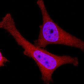 p16INK4a / CDKN2A was detected in immersion fixed HeLa human cervical epithelial carcinoma cell line using Goat Anti-Human p16INK4a / CDKN2A Antigen Affinity-purified Polyclonal Antibody (Catalog # AF5779) at 0.3 µg/mL for 3 hours at room temperature. Cells were stained using the NorthernLights™ 557-conjugated Anti-Goat IgG Secondary Antibody (red; Catalog # NL001) and counterstained with DAPI (blue). Specific staining was localized to cytoplasm and nuclei. View our protocol for Fluorescent ICC Staining of Cells on Coverslips.