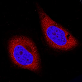 p23/PTGES3 was detected in immersion fixed HeLa human cervical epithelial carcinoma cell line using Mouse Anti-Human/Mouse p23/PTGES3 Monoclonal Antibody (Catalog # MAB100391) at 8 µg/mL for 3 hours at room temperature. Cells were stained using the NorthernLights™ 557-conjugated Anti-Mouse IgG Secondary Antibody (red; Catalog # NL007) and counterstained with DAPI (blue). Specific staining was localized to cytoplasm. View our protocol for Fluorescent ICC Staining of Cells on Coverslips.