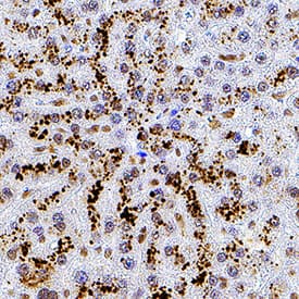 p23/PTGES3 was detected in immersion fixed paraffin-embedded sections of human liver using Mouse Anti-Human/Mouse p23/PTGES3 Monoclonal Antibody (Catalog # MAB100391) at 5 µg/mL for 1 hour at room temperature followed by incubation with the Anti-Mouse IgG VisUCyte™ HRP Polymer Antibody (Catalog # VC001). Before incubation with the primary antibody, tissue was subjected to heat-induced epitope retrieval using Antigen Retrieval Reagent-Basic (Catalog # CTS013). Tissue was stained using DAB (brown) and counterstained with hematoxylin (blue). Specific staining was localized to cytoplasm. View our protocol for IHC Staining with VisUCyte HRP Polymer Detection Reagents.