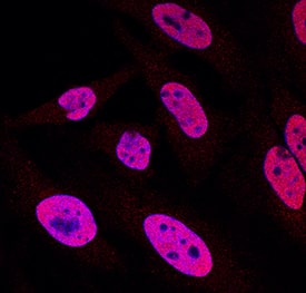 p300 was detected in immersion fixed HeLa human cervical epithelial carcinoma cell line using Goat Anti-Human p300 Antigen Affinity-purified Polyclonal Antibody (Catalog # AF3789) at 1.7 µg/mL for 3 hours at room temperature. Cells were stained using the NorthernLights™ 557-conjugated Anti-Goat IgG Secondary Antibody (red; Catalog # NL001) and counterstained with DAPI (blue). Specific staining was localized to nuclei. View our protocol for Fluorescent ICC Staining of Cells on Coverslips.