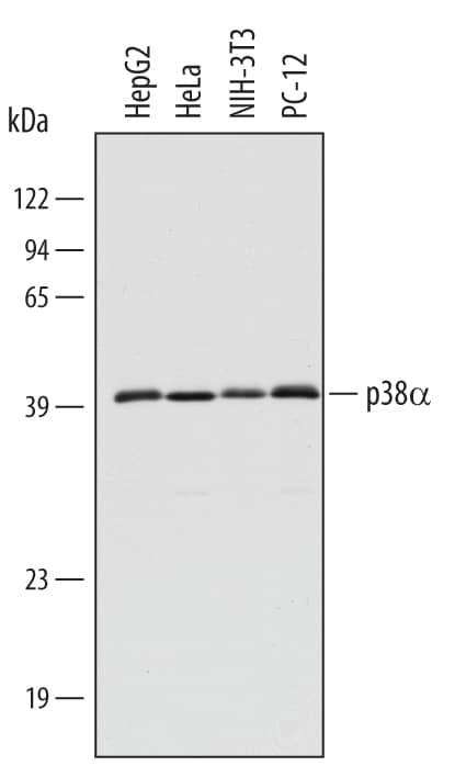 Western Blot p38 alpha Antibody [Unconjugated]