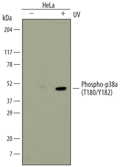Western blot shows lysates of HeLa human cervical epithelial carcinoma cell line untreated (-) or treated (+) with 20 mJ/cm2ultraviolet light (UV) followed by a 30 minute recovery. PVDF membrane was probed with 1 µg/mL of Mouse Anti-Human Phospho-p38a (T180/Y182) Monoclonal Antibody (Catalog # MAB8691) followed by HRP-conjugated Anti-Mouse IgG Secondary Antibody (Catalog # HAF007). A specific band was detected for Phospho-p38a (T180/Y182) at approximately 45 kDa (as indicated). This experiment was conducted under reducing conditions and using Immunoblot Buffer Group 1.