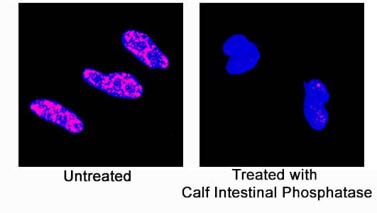 p38a phosphorylated at T180/Y182 was detected in immersion fixed HeLa human cervical epithelial carcinoma cell line, untreated or treated with calf intestinal phosphatase, using Rat Anti-Human Phospho-p38a (T180/Y182) Monoclonal Antibody (Catalog # MAB8692) at 25 µg/mL for 3 hours at room temperature. Cells were stained using the NorthernLights™ 557-conjugated Anti-Rat IgG Secondary Antibody (red; Catalog # NL013) and counterstained with DAPI (blue). Specific staining was localized to nuclei. View our protocol for Fluorescent ICC Staining of Cells on Coverslips.