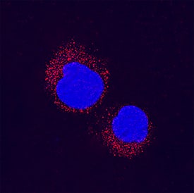 p38 beta /MAPK11 was detected in immersion fixed Jurkat human acute T cell leukemia cell line using Mouse Anti-Human p38 beta /MAPK11 Monoclonal Antibody (Catalog # MAB3274) at 8 µg/mL for 3 hours at room temperature. Cells were stained using the NorthernLights™ 557-conjugated Anti-Mouse IgG Secondary Antibody (red; Catalog # NL007) and counterstained with DAPI (blue). Specific staining was localized to cytoplasm. View our protocol for Fluorescent ICC Staining of Non-adherent Cells.