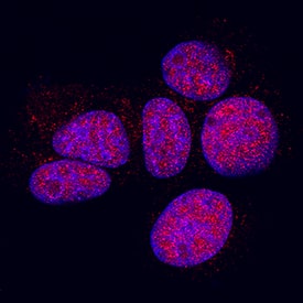 p38 gamma was detected in immersion fixed MCF-7 human breast cancer cell line using Rabbit Anti-Human/Mouse/Rat p38 gamma Antigen Affinity-purified Polyclonal Antibody (Catalog # AF1347) at 3 µg/mL for 3 hours at room temperature. Cells were stained using the NorthernLights™ 557-conjugated Anti-Rabbit IgG Secondary Antibody (red; Catalog # NL004) and counterstained with DAPI (blue). Specific staining was localized to nuclei. View our protocol for Fluorescent ICC Staining of Cells on Coverslips.