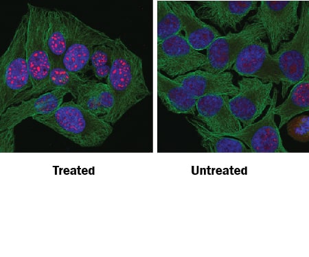 <b>Biological Strategies Validation. </b>p53 phosphorylated at S15 was detected in immersion fixed HeLa human cervical epithelial carcinoma cell line treated with UV light (left panel) or untreated (right panel) using Rabbit Anti-Human Phospho-p53 (S15) Antigen Affinity-purified Polyclonal Antibody (Catalog # AF1043) at 10 µg/mL for 3 hours at room temperature. Cells were stained using the NorthernLights™ 557-conjugated Anti-Rabbit IgG Secondary Antibody (red; Catalog # NL004) and counterstained with DAPI (blue). Specific staining was localized to nuclei. Cells were co-stained using Rat Anti-Tubulin (Catalog # NB600-506, Novus Biologicals) and NorthernLights™ 493-conjugated Anti-Rat IgG Secondary Antibody (green; Catalog # NL015). View our protocol for Fluorescent ICC Staining of Cells on Coverslips.