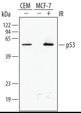 Western blot shows lysates of CEM human T‑lymphoblastoid cell line and MCF‑7 human breast cancer cell line untreated (-) or treated (+) with 10 Gy ionizing radiation (IR) for 1 hour. PVDF membrane was probed with 1:5000 dilution of Human/Mouse/Rat p53 HRP-conjugated Antigen Affinity-purified Polyclonal Antibody (Catalog # HAF1355). A specific band was detected for p53 at approximately 53 kDa (as indicated). This experiment was conducted under reducing conditions and using Immunoblot Buffer Group 1.