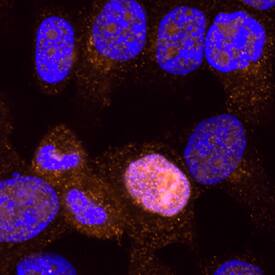 <b>Biological Strategies Validation. </b>p53 was detected in immersion fixed HeLa human cervical epithelial carcinoma cell line using Mouse Anti-Human/Mouse/Rat p53 Monoclonal Antibody (Catalog # MAB1355) at 3 µg/mL for 3 hours at room temperature. Cells were stained using the NorthernLights™ 557-conjugated Anti-Mouse IgG Secondary Antibody (red; Catalog # NL007) and counterstained with DAPI (blue). Specific staining was localized to cytoplasm and nuclei. View our protocol for Fluorescent ICC Staining of Cells on Coverslips.