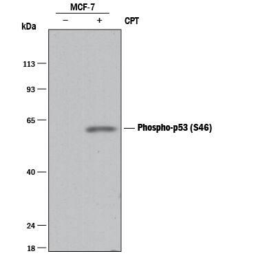 Western blot shows lysates of MCF-7 human breast cancer cell line untreated (-) or treated (+) with 1 µM Camptothecin (CPT) for 5 hours. PVDF membrane was probed with 0.2 µg/mL of Rabbit Anti-Human Phospho-p53 (S46) Monoclonal Antibody (Catalog # MAB1489) followed by HRP-conjugated Anti-Rabbit IgG Secondary Antibody (Catalog # HAF008). A specific band was detected for phospho-p53 (S46) at approximately 53 kDa (as indicated). This experiment was conducted under reducing conditions and using Immunoblot Buffer Group 1.
