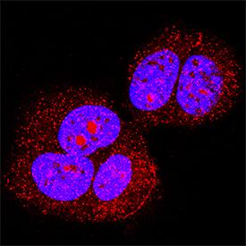 <b>Biological Strategies Validation. </b>p53 phosphorylated at S392 was detected in immersion fixed MCF-7 human breast cancer cell line using Rabbit Anti-Human Phospho-p53 (S392) Monoclonal Antibody (Catalog # MAB2996) at 3 µg/mL for 3 hours at room temperature. Cells were stained using the NorthernLights™ 557-conjugated Anti-Rabbit IgG Secondary Antibody (red; Catalog # NL004) and counterstained with DAPI (blue). Specific staining was localized to cytoplasm and nuclei. View our protocol for Fluorescent ICC Staining of Cells on Coverslips.
