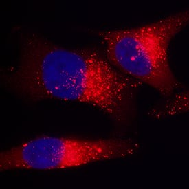 <b>Biological Strategies Validation. </b>p62/SQSTM1 was detected in immersion fixed HeLa human cervical epithelial carcinoma cell line treated with staurosporine using Mouse Anti-Human/Mouse/Rat p62/SQSTM1 Monoclonal Antibody (Catalog # MAB8028R) at 3 µg/mL for 3 hours at room temperature. Cells were stained using the NorthernLights™ 557-conjugated Anti-Mouse IgG Secondary Antibody (red; Catalog # NL007) and counterstained with DAPI (blue). Specific staining was localized to cytoplasm. View our protocol for Fluorescent ICC Staining of Cells on Coverslips.