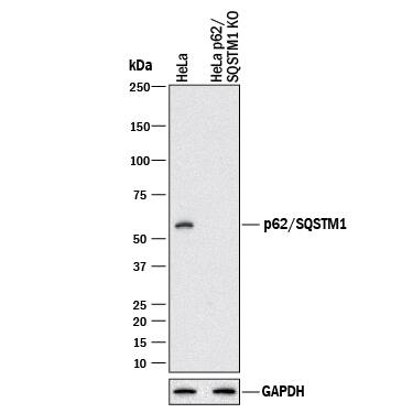 <b>Genetic Strategies Validation. </b>Western blot shows lysates of HeLa human cervical epithelial carcinoma parental cell line and p62/SQSTM1 knockout HeLa cell line (KO). PVDF membrane was probed with 1 µg/mL of Mouse Anti-Human/Mouse/Rat p62/SQSTM1 Monoclonal Antibody (Catalog # MAB8028) followed by HRP-conjugated Anti-Mouse IgG Secondary Antibody (Catalog # HAF018). A specific band was detected for p62/SQSTM1 at approximately 62 kDa (as indicated) in the parental HeLa cell line, but is not detectable in the knockout HeLa cell line. GAPDH (Catalog # MAB5718) is shown as a loading control. This experiment was conducted under reducing conditions and using Immunoblot Buffer Group 1.