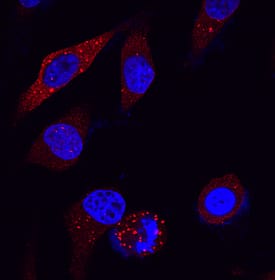 Immunocytochemistry p62/SQSTM1 Antibody (864807) [Unconjugated]
