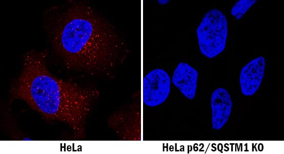 Knockout Validated p62/SQSTM1 Antibody (864807) [Unconjugated]