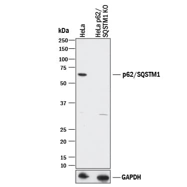 Knockout Validated p62/SQSTM1 Antibody (864807) [Unconjugated]