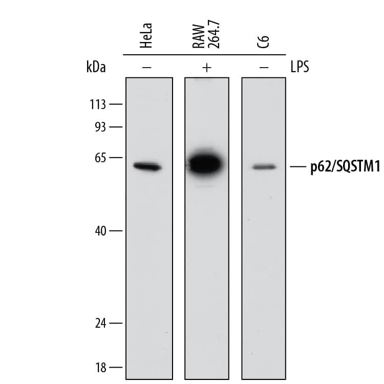Western Blot p62/SQSTM1 Antibody (864807) [Unconjugated]