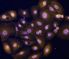 p63/TP73L was detected in immersion fixed SCC-25 human tongue carcinoma cell line using Goat Anti-Human p63/TP73L Antigen Affinity-purified Polyclonal Antibody (Catalog # AF1916) at 10 µg/mL for 3 hours at room temperature. Cells were stained using the NorthernLights™ 557-conjugated Anti-Goat IgG Secondary Antibody (yellow; Catalog # NL001) and counterstained with DAPI (blue). Specific staining was localized to nuclei. View our protocol for Fluorescent ICC Staining of Cells on Coverslips.