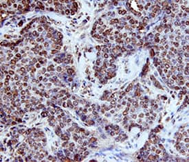 Immunohistochemistry p63/TP73L Antibody [Unconjugated]