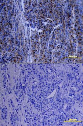 Immunohistochemistry p70 S6 Kinase/S6K Antibody [Unconjugated]