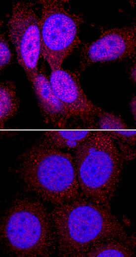Immunocytochemistry p70 S6 Kinase/S6K [p Thr389] Antibody (1045C) [Unconjugated]