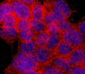 <b>Biological Strategies Validation. </b>p70 S6 Kinase phosphorylated at T229 was detected in immersion fixed MCF-7 human breast cancer cell line treated with 100 ng/mL Recombinant Human IGF-I (Catalog # 291-G1) using Rabbit Anti-Human Phospho-p70 S6 Kinase (T229) Monoclonal Antibody (Catalog # MAB8964) at 2.5 µg/mL for 3 hours at room temperature. Cells were stained using the NorthernLights™ 557-conjugated Anti-Rabbit IgG Secondary Antibody (red; Catalog # NL004) and counterstained with DAPI (blue). Specific staining was localized to cytoplasm. View our protocol for Fluorescent ICC Staining of Cells on Coverslips.