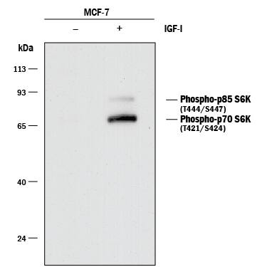 Western blot shows lysates of MCF-7 human breast cancer cell line untreated (-) or treated (+) with 100 ng/mL Recombinant Human IGF-I (Catalog # 291-G1) for 1 hour. PVDF membrane was probed with 0.1 µg/mL of Rabbit Anti-Human/Mouse/Rat Phospho-p70 S6 Kinase (T421/S424) Monoclonal Antibody (Catalog # MAB8965) followed by HRP-conjugated Anti-Rabbit IgG Secondary Antibody (Catalog # HAF008). Specific bands were detected for Phopsho-p70 S6 Kinase (T421/S424) at approximately 70 kDa and Phospho-p85 S6 Kinase (T444/S447) at 85 kDa (as indicated). This experiment was conducted under reducing conditions and using Immunoblot Buffer Group 1.