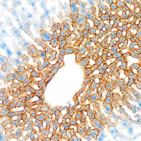 pIgR was detected in immersion fixed frozen sections of mouse liver using Goat Anti-Mouse pIgR Antigen Affinity-purified Polyclonal Antibody (Catalog # AF2800) at 1 µg/mL overnight at 4 °C. Tissue was stained using the Anti-Goat HRP-DAB Cell & Tissue Staining Kit (brown; Catalog # CTS008) and counterstained with hematoxylin (blue). Specific staining was localized to hepatocyte cytoplasm and plasma membrane. View our protocol for Chromogenic IHC Staining of Frozen Tissue Sections.