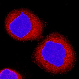 sFRP-1 was detected in immersion fixed MBA-MB-468 human breast cancer cell line using Goat Anti-Human sFRP-1 Antigen Affinity-purified Polyclonal Antibody (Catalog # AF1384) at 15 µg/mL for 3 hours at room temperature. Cells were stained using the NorthernLights™ 557-conjugated Anti-Goat IgG Secondary Antibody (red; Catalog # NL001) and counterstained with DAPI (blue). Specific staining was localized to cytoplasm. View our protocol for Fluorescent ICC Staining of Cells on Coverslips.