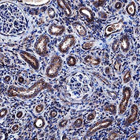 sFRP-1 was detected in immersion fixed paraffin-embedded sections of human kidney using Goat Anti-Human sFRP-1 Antigen Affinity-purified Polyclonal Antibody (Catalog # AF1384) at 1 µg/mL overnight at 4 °C. Tissue was stained using the Anti-Goat HRP-DAB Cell & Tissue Staining Kit (brown; Catalog # CTS008) and counterstained with hematoxylin (blue). Specific staining was localized to epithelial cell cytoplasm in convoluted tubules. View our protocol for Chromogenic IHC Staining of Paraffin-embedded Tissue Sections.