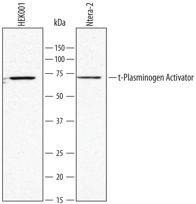 Western Blot t-Plasminogen Activator/tPA Antibody