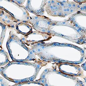 uPAR was detected in perfusion fixed frozen sections of mouse kidney using Goat Anti-Mouse uPAR Antigen Affinity-purified Polyclonal Antibody (Catalog # AF534) at 3 µg/mL overnight at 4 °C. Tissue was stained using the Anti-Goat HRP-DAB Cell & Tissue Staining Kit (brown; CTS008) and counterstained with hematoxylin (blue). Specific staining was localized to plasma membrane in epithelial cells. View our protocol for Chromogenic IHC Staining of Frozen Tissue Sections.