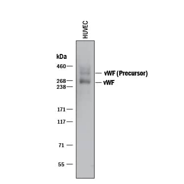 Western blot shows lysates of HUVEC human umbilical vein endothelial cells. PVDF membrane was probed with 0.5 µg/mL of Sheep Anti-Human vWF-A2 Antigen Affinity-purified Polyclonal Antibody (Catalog # AF2764) followed by HRP-conjugated Anti-Sheep IgG Secondary Antibody (Catalog # HAF016). Specific bands were detected for vWF at approximately 250 kDa and the vWF precursor at 360-460 kDa (as indicated). This experiment was conducted under reducing conditions and using Immunoblot Buffer Group 1.