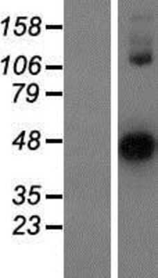 Western Blot Ovastacin Overexpression Lysate