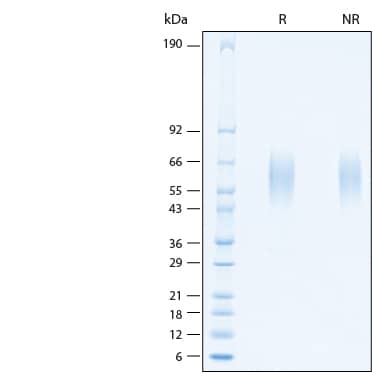 2 μg/lane of Recombinant Human CD200R1 Avi-tag His-tag Protein (Catalog # AVI10053) was resolved with SDS-PAGE under reducing (R) and non-reducing (NR) conditions and visualized by Coomassie® Blue staining, showing bands at 55-65 kDa.