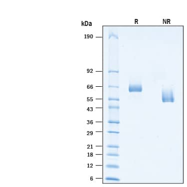 2 μg/lane of Biotinylated Recombinant Human MuSK Avi-tag His-tag Protein (Catalog # AVI10189) was resolved with SDS-PAGE under reducing (R) and non-reducing (NR) conditions and visualized by Coomassie® Blue staining, showing bands at 59-67 kDa.
