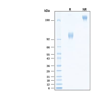 SDS-Page GUCY2C [Biotin]