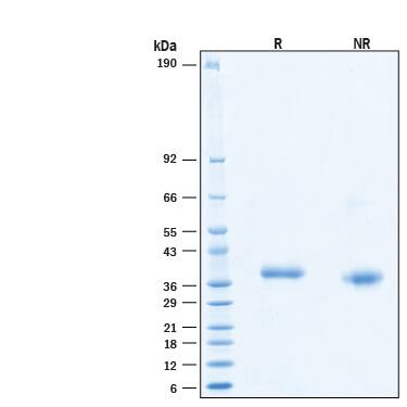 2 μg/lane of Biotinylated Recombinant SARS-CoV-2 B.1.1.7 S RBD Avi-tag Protein (Catalog # AVI10730) was resolved with SDS-PAGE under reducing (R) and non-reducing (NR) conditions and visualized by Coomassie® Blue staining, showing bands at 34-38 kDa.