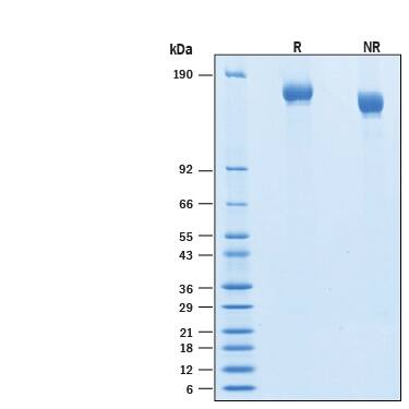 2 μg/lane of Biotinylated Recombinant SARS-CoV-2 B.1.1.7 S GCN4-IZ Avi-tag Protein  (Catalog # AVI10796) was resolved with SDS-PAGE under reducing (R) and non-reducing (NR) conditions and visualized by Coomassie® Blue staining, showing bands at 140-170 kDa.