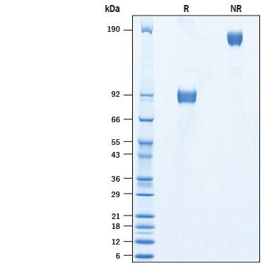 SDS-Page IL-18R alpha/IL-1 R5 [Biotin]