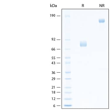 2 μg/lane of Recombinant Human IL-22BP Fc Chimera Avi-tag Protein (Catalog # AVI1087) was resolved with SDS-PAGE under reducing (R) and non-reducing (NR) conditions and visualized by Coomassie® Blue staining, showing bands at 73-82 kDa and 146-164 kDa, respectively.